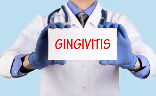 Gingivitis